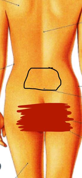 Bolesť chrbta po autonehode: Možné príčiny?