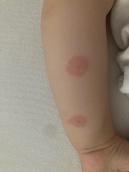 Od čoho sú tieto štípance?