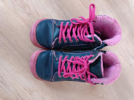 Zateplené topánky protetika, protetika,32