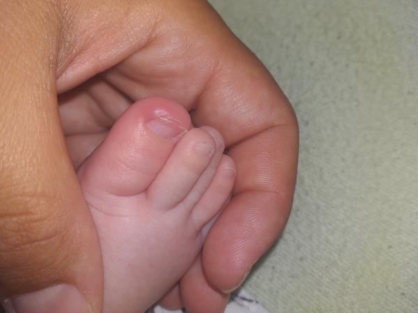 Necht u trojmesačného bábätka