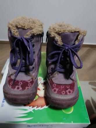 Krasne zimné topánočky protetika, protetika,24