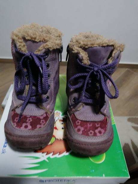 Krasne zimné topánočky protetika, protetika,24