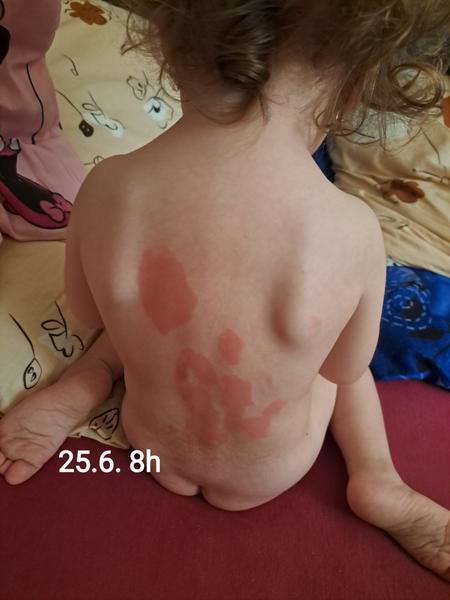 Červený fľak od vody