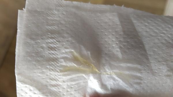 Výtok v 29. týždni