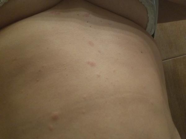 Čo si mám dať na takýto výsyp? Mám HIT