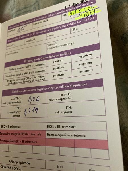 Je Nt hodnota v mojej knižke v poriadku?