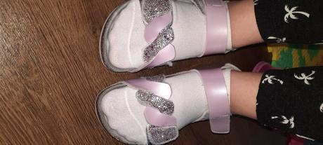 Sandalky ortopedicke, 33