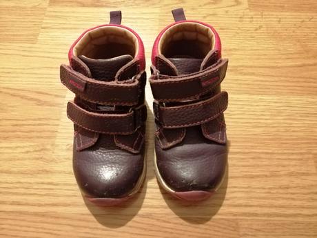 Topanky protetika, protetika,23