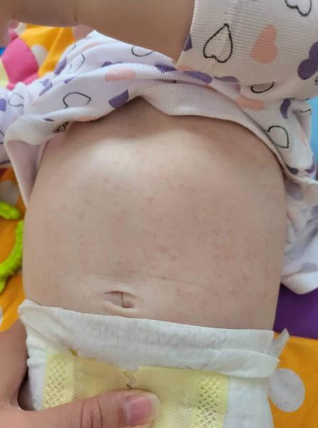 Môže to byť šiesta choroba?