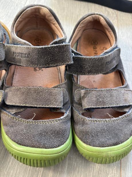 Sandálky protetika, protetika,31