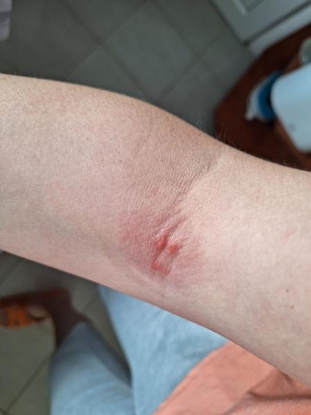 Čo to mám na ruke?