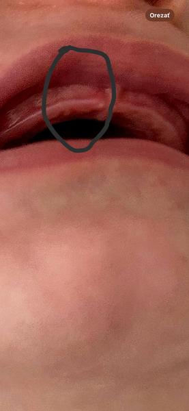 Je to zub alebo nie? Diskutujte tu!