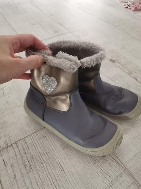 Protetika lory, protetika,31