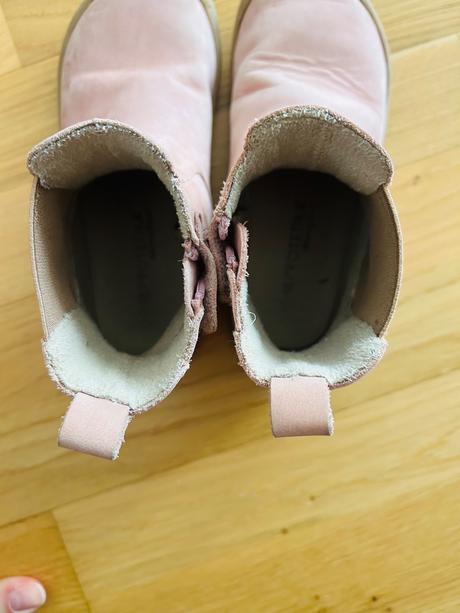 Protetika prechodne topanky, protetika,30