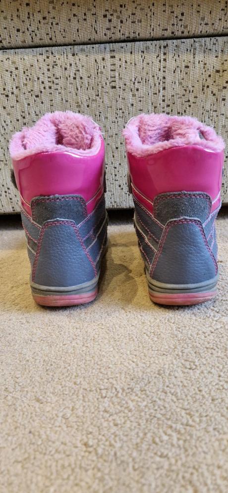 Čižmy, protetika,25