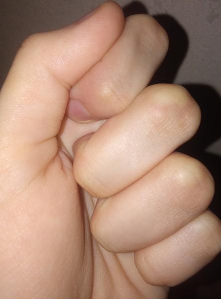 Je to skákavý prst?