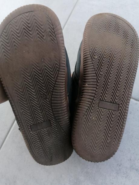 Prechodné protetika, protetika,35