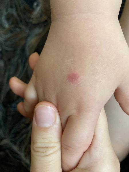 Sú to kiahne alebo 6-ta choroba?