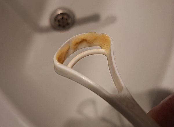 Oranžový povlak na jazyku - poraďte