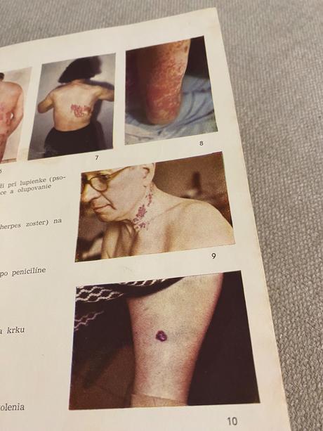 Vnútorné lekárstvo 2,