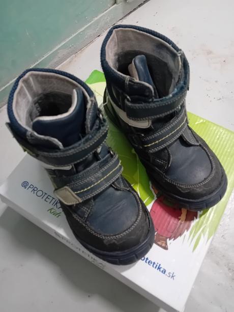 Protetika zimne topanocky, protetika,31