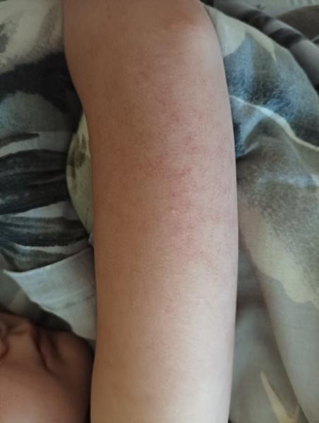 Je to piata choroba? 