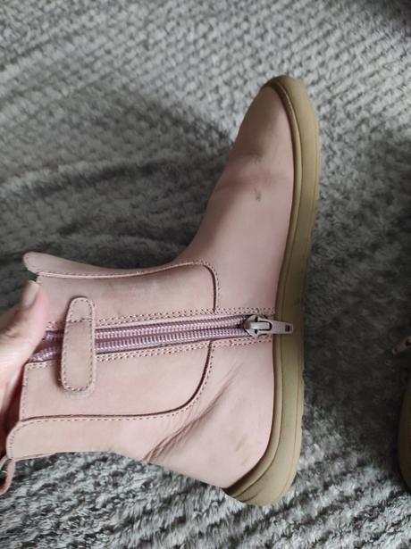 Prechodné barefoot topánky protetika, protetika,36