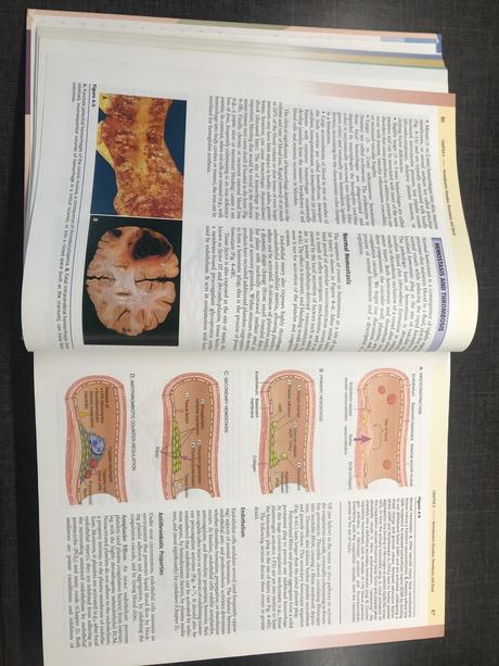 Robbins  basic pathology, 
