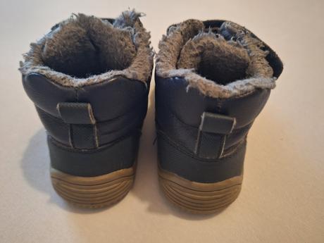 Protetika zimne, protetika,24