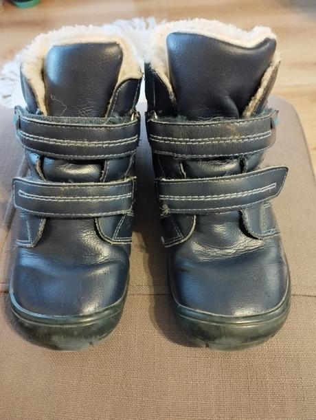 Barefoot zimne topanky, protetika,30