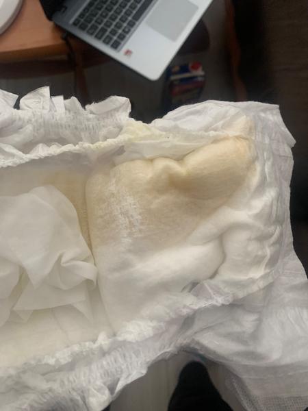 Je farba moču môjho 3-týždňového synčeka v poriadku?