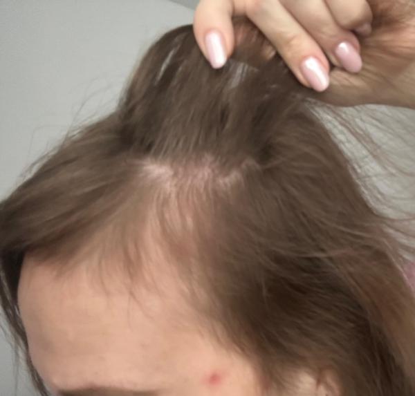 Zúfalosť z neustále suchých vlasov