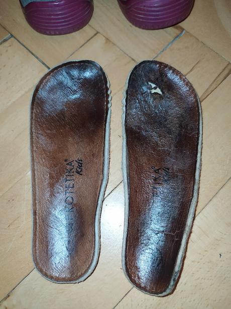 Sandálky, protetika,24