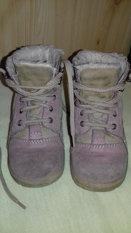 Zimne ortopedicke topanočky, protetika,24