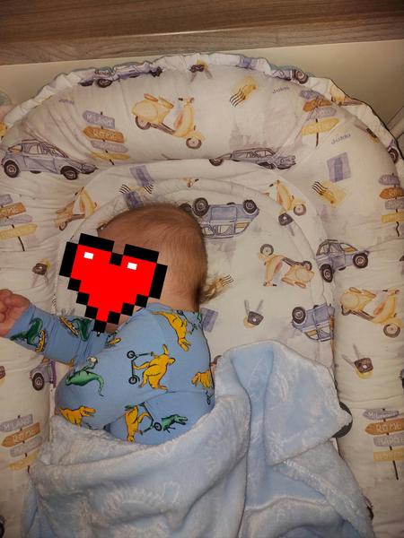 Zležaná hlavička u 5-mesačného