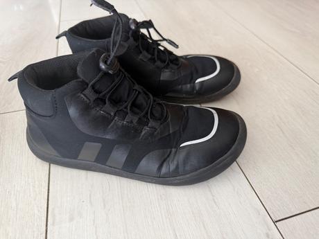 Protetika, protetika,34