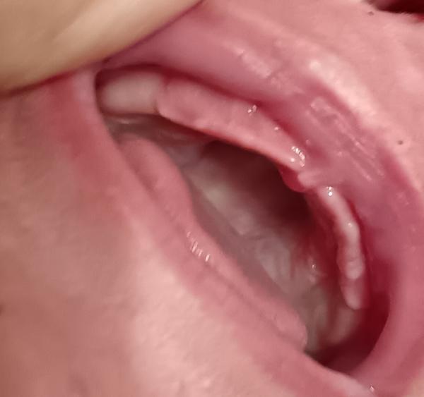 Prvé príznaky rastu zúbkov u dvojmesačného bábätka