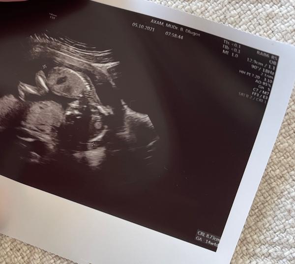 Je veľkosť môjho bábätka v 16. týždni v poriadku?