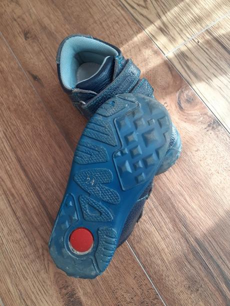 Prechodne topanky, protetika,25