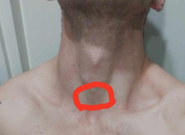 Máte problémy s krkom, ktoré sa nezlepšujú?