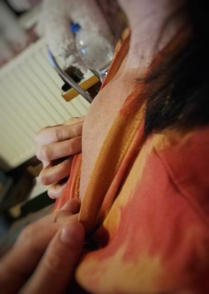 Čo znamená takýto opuch na hrudníku?