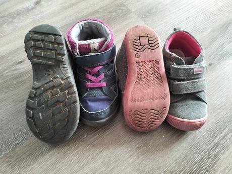 Dva páry topánočiek, protetika,24