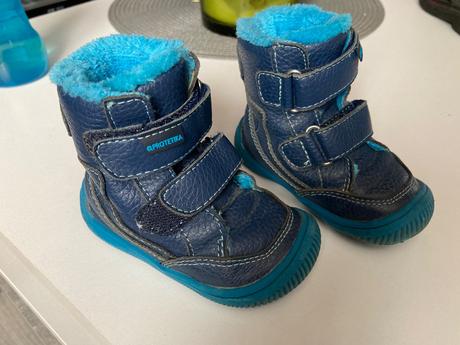 Prechodné topánky protetika, protetika,20