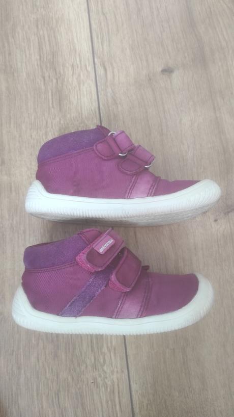 Celoročky protetika, protetika,24