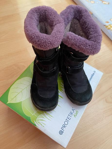 Čižmx, protetika,31