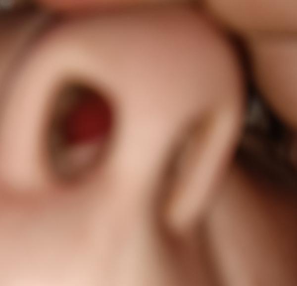 Ako riešiť opuchnuté vnútro nosa?