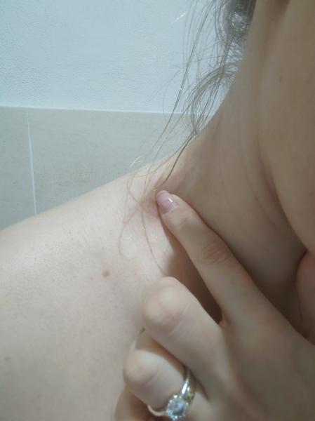 Bolestivá pohyblivá uzlina: Kedy navštíviť lekára?