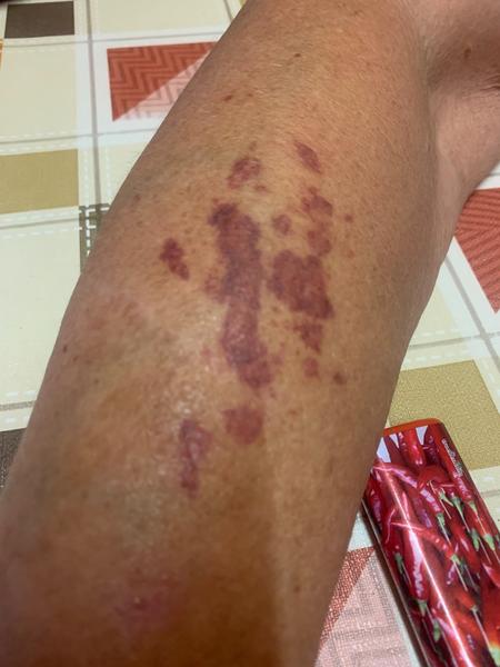 Čo môžu byť tieto fľaky?