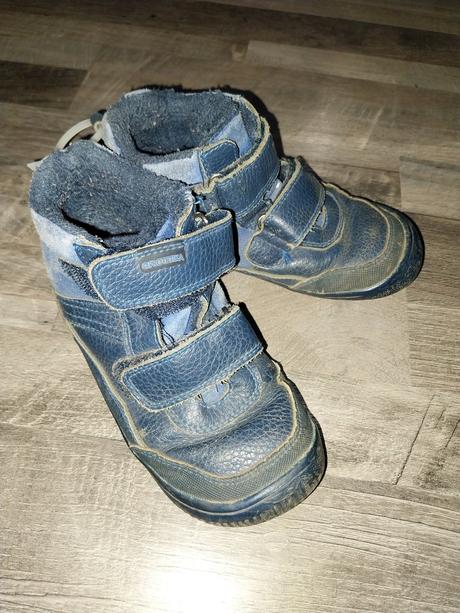Topanky protetika, protetika,28