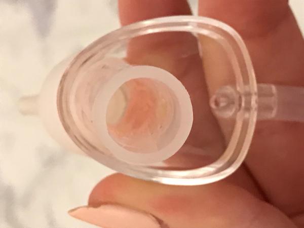 Krvavé soplíky u 2-mesačného bábätka